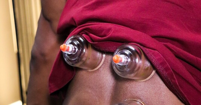 Cupping Therapy for Low Back Tightness: Why Adding Motion Speeds Up Recovery Between Adjustments image